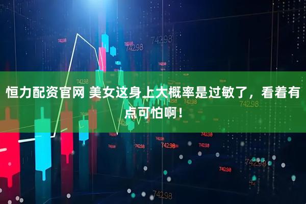 恒力配资官网 美女这身上大概率是过敏了，看着有点可怕啊！